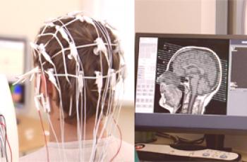 EEG a MRI mozku: srovnání metod a které je lepší