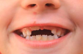 Jak se dětské zuby liší od domorodých