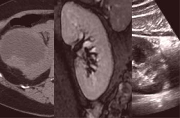 Što je bolje i pouzdanije od CT, MRI ili ultrazvuka bubrega?