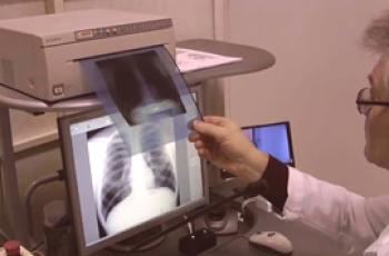 Jaký je rozdíl mezi rentgenovými paprsky a fluorografií