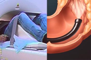 Resonancia magnética intestinal y colonoscopia: cómo difieren y qué es mejor