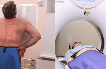 ¿Qué es mejor las radiografías de los pulmones o la TC y en qué se diferencian?