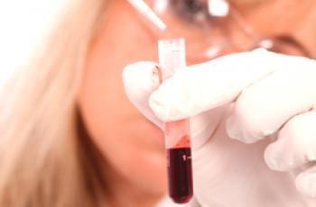 Quelle est la différence entre une numération sanguine complète et une numération clinique?
