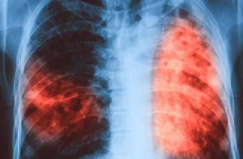 Lo que distingue a la neumonía de la tuberculosis: características de las enfermedades.