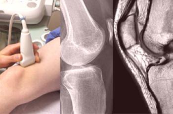 ¿Cuál es la mejor ecografía, radiografía o resonancia magnética de la rodilla?