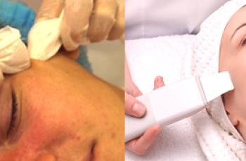 ¿Cuál es la mejor limpieza facial mecánica o ultrasónica?