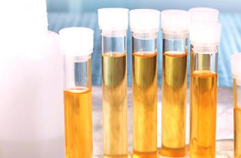 Koja je razlika između opće analize urina i Nechiporenko?